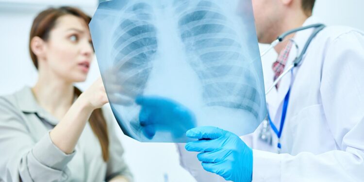 La Comunidad de Madrid registra un descenso del 30% de los casos de tuberculosis durante la pandemia