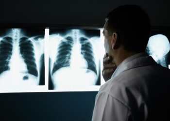 La Comunidad de Madrid participa en un ensayo que cambia el paradigma de tratamiento del cáncer de pulmón en estadios intermedios